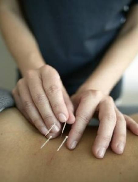 acupuncteur epernay avis