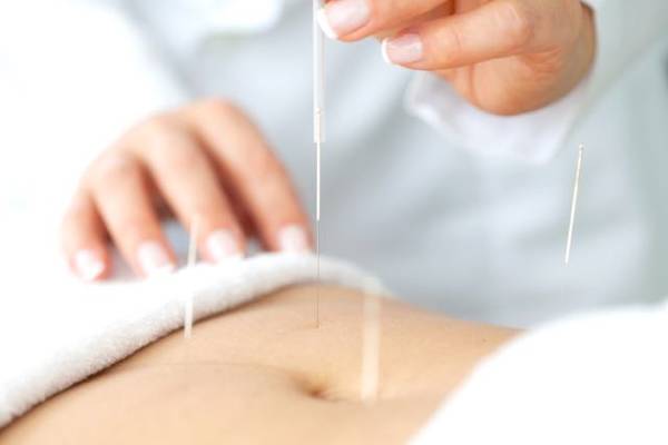 acupuncture ussel 19