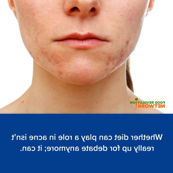 comment arreter l acné inflammatoire