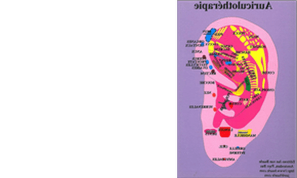acupuncture pour les nuls avis