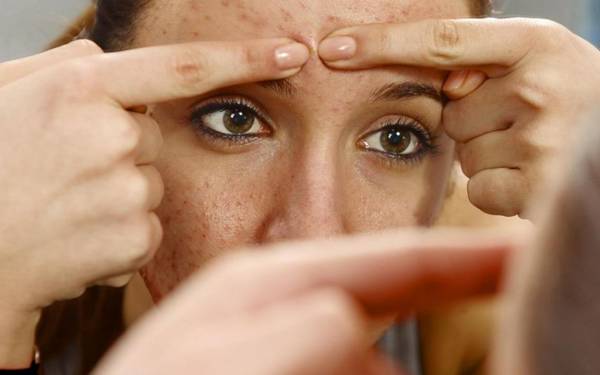 quelle pilule contraceptive acné