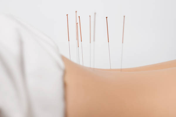 acupuncteur fecamp avis