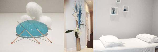 acupuncture migraine