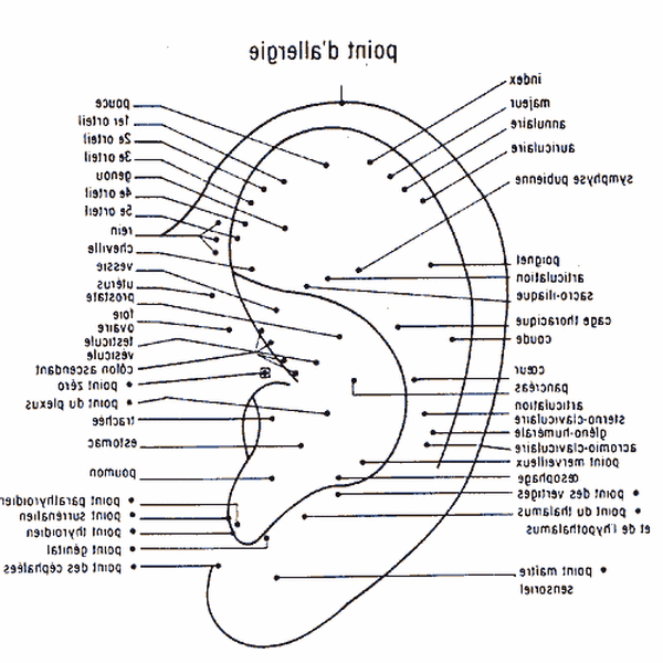 acupuncture insomnie avis